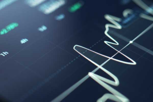 周睿金：黄金探底回升，日内低多思路为主！